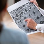 Doctor looking at the results of an MRI